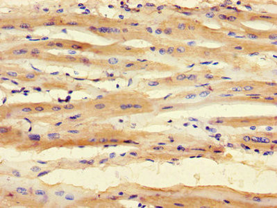 SMNDC1 Antibody in Immunohistochemistry (Paraffin) (IHC (P))