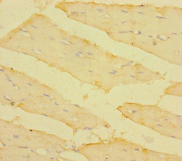 TM4SF5 Antibody in Immunohistochemistry (Paraffin) (IHC (P))