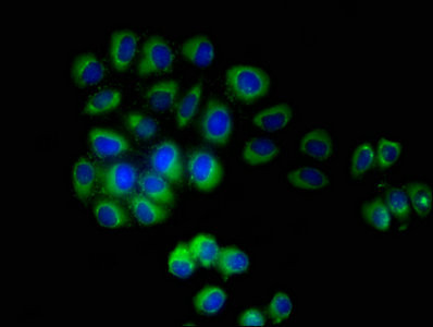 TMEM161B Antibody in Immunocytochemistry (ICC/IF)