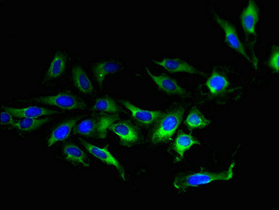TMEM207 Antibody in Immunocytochemistry (ICC/IF)