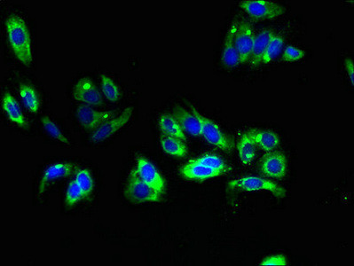 TMEM31 Antibody in Immunocytochemistry (ICC/IF)