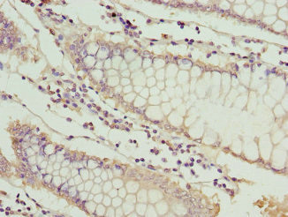 MT1G Antibody in Immunohistochemistry (Paraffin) (IHC (P))