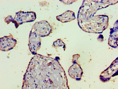 Complement C4b Antibody in Immunohistochemistry (Paraffin) (IHC (P))