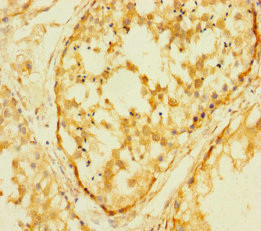 FAM127C Antibody in Immunohistochemistry (Paraffin) (IHC (P))