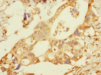 FAM187B Antibody in Immunohistochemistry (Paraffin) (IHC (P))
