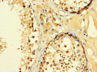 C2orf83 Antibody in Immunohistochemistry (Paraffin) (IHC (P))