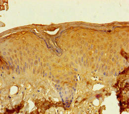 LCE2A Antibody in Immunohistochemistry (Paraffin) (IHC (P))