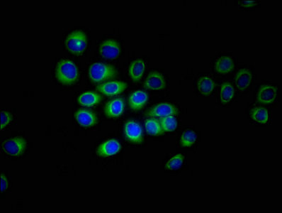 ERVK-6 Antibody in Immunocytochemistry (ICC/IF)