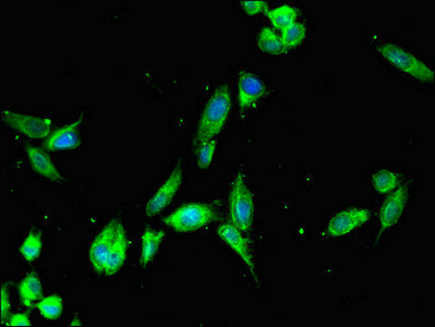 FAM182A Antibody in Immunocytochemistry (ICC/IF)