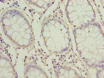 ZNF767P Antibody in Immunohistochemistry (Paraffin) (IHC (P))