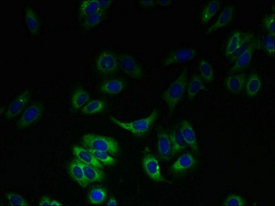 SLC23A3 Antibody in Immunocytochemistry (ICC/IF)