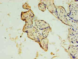 CCDC135 Antibody in Immunohistochemistry (Paraffin) (IHC (P))