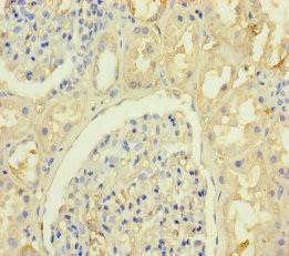 KRTAP8-1 Antibody in Immunohistochemistry (Paraffin) (IHC (P))