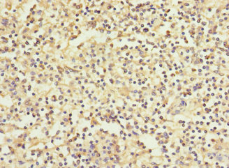 WFDC11 Antibody in Immunohistochemistry (Paraffin) (IHC (P))