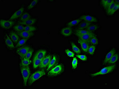 LSMEM2 Antibody in Immunocytochemistry (ICC/IF)