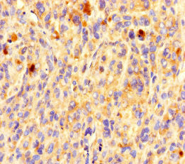 OR5L1 Antibody in Immunohistochemistry (Paraffin) (IHC (P))