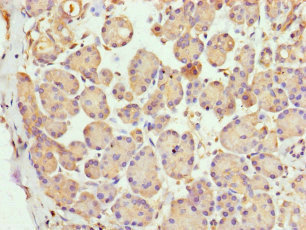 LYG1 Antibody in Immunohistochemistry (Paraffin) (IHC (P))