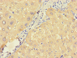 ZNF738 Antibody in Immunohistochemistry (Paraffin) (IHC (P))