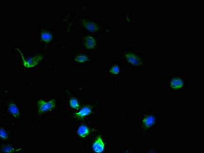 SSMEM1 Antibody in Immunocytochemistry (ICC/IF)