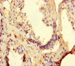 TDRD9 Antibody in Immunohistochemistry (Paraffin) (IHC (P))