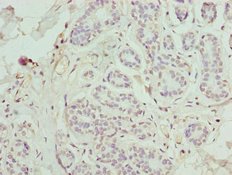 FAM71F1 Antibody in Immunohistochemistry (Paraffin) (IHC (P))