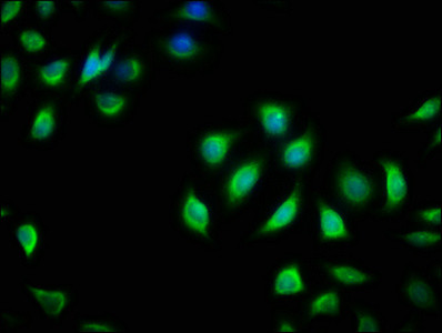 RIT2 Antibody in Immunocytochemistry (ICC/IF)