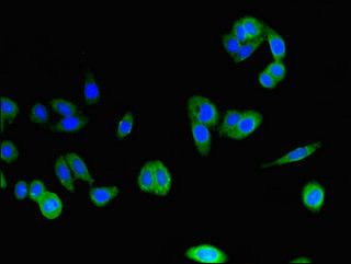 CLSTN2 Antibody in Immunocytochemistry (ICC/IF)