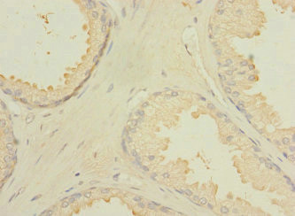 CXorf21 Antibody in Immunohistochemistry (Paraffin) (IHC (P))