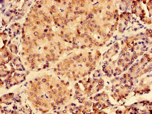 CEP126 Antibody in Immunohistochemistry (Paraffin) (IHC (P))