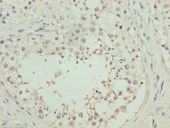 RHPN1-AS1 Antibody in Immunohistochemistry (Paraffin) (IHC (P))