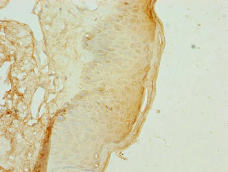 KRTAP3-2 Antibody in Immunohistochemistry (Paraffin) (IHC (P))