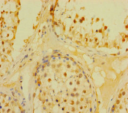DUSP21 Antibody in Immunohistochemistry (Paraffin) (IHC (P))