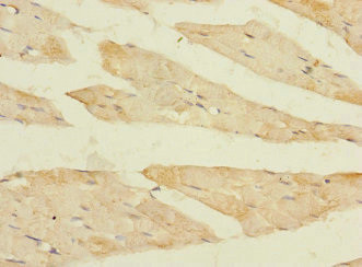 FBXO40 Antibody in Immunohistochemistry (Paraffin) (IHC (P))