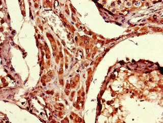 ARRDC1-AS1 Antibody in Immunohistochemistry (Paraffin) (IHC (P))