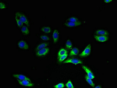 HIGD1B Antibody in Immunocytochemistry (ICC/IF)