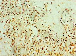 Metadherin Antibody in Immunohistochemistry (Paraffin) (IHC (P))