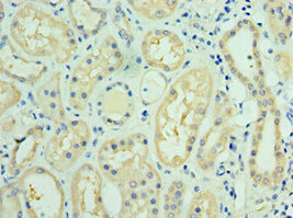 FUT6 Antibody in Immunohistochemistry (Paraffin) (IHC (P))