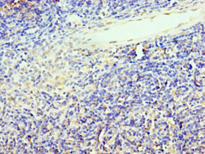 TCF12 Antibody in Immunohistochemistry (Paraffin) (IHC (P))