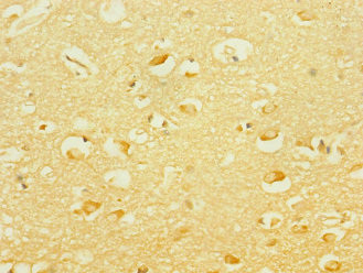 PCDH19 Antibody in Immunohistochemistry (Paraffin) (IHC (P))