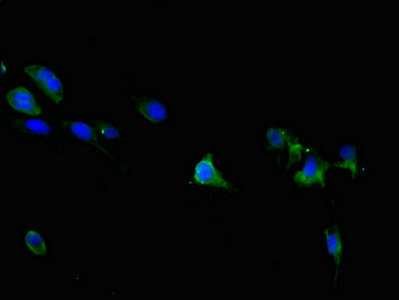 TRPM6 Antibody in Immunocytochemistry (ICC/IF)