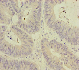 MCCC1 Antibody in Immunohistochemistry (Paraffin) (IHC (P))