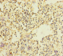 SLC35A1 Antibody in Immunohistochemistry (Paraffin) (IHC (P))