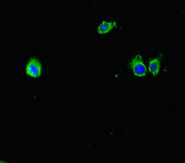 Mup6 Antibody in Immunocytochemistry (ICC/IF)