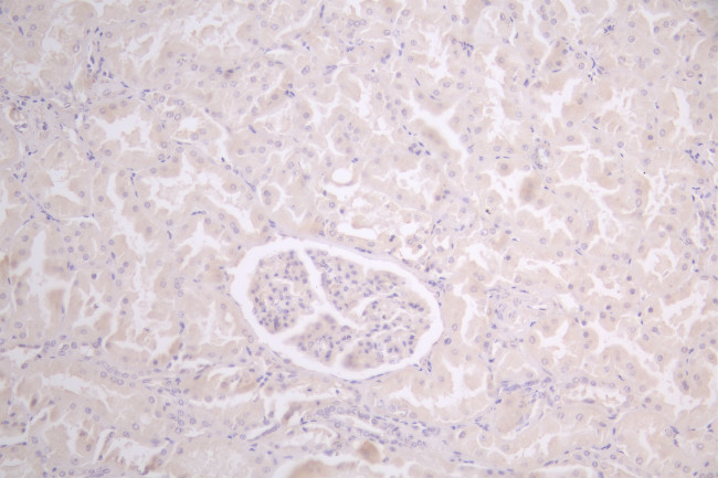 CCDC111 Antibody in Immunohistochemistry (Paraffin) (IHC (P))