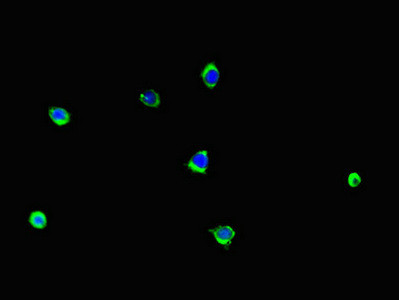 LCE1B Antibody in Immunocytochemistry (ICC/IF)
