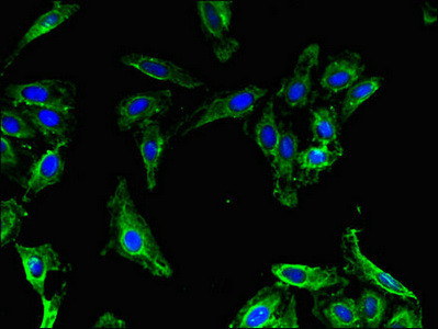 MAP1LC3B2 Antibody in Immunocytochemistry (ICC/IF)