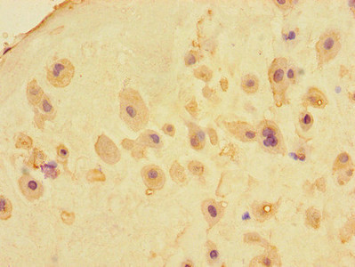 MEIKIN Antibody in Immunohistochemistry (Paraffin) (IHC (P))