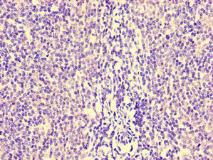 HCP5 Antibody in Immunohistochemistry (Paraffin) (IHC (P))