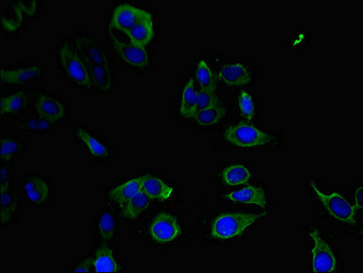 PPP1R12C Antibody in Immunocytochemistry (ICC/IF)