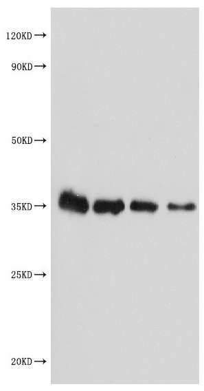 MALD1 Antibody in Western Blot (WB)